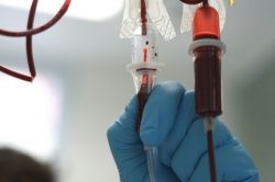 Поможет ли переливание крови от прищей?