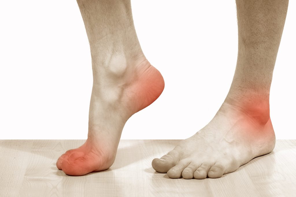 Уплотнения на ногах под кожей: види, профилактика