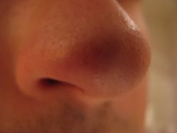 Фурункул в носу: лечение, причини, осложнения