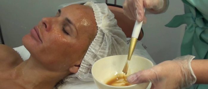 Чистка лица от прыщей